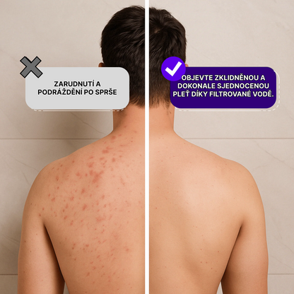 Vysokotlaká filtrační sprchová hlavice